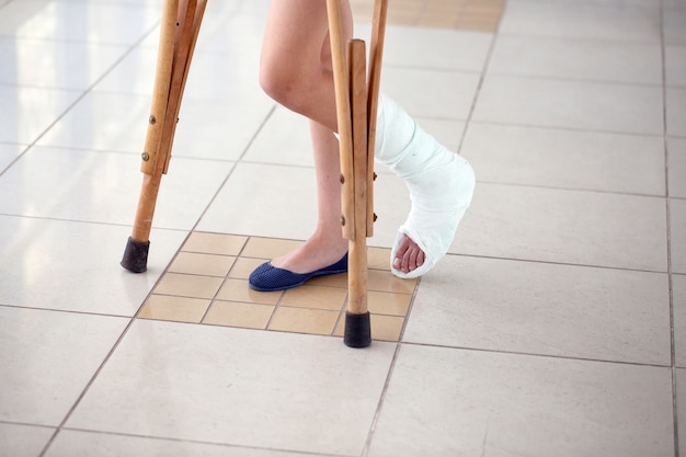 Una mujer joven está con muletas en el pasillo del hospital.