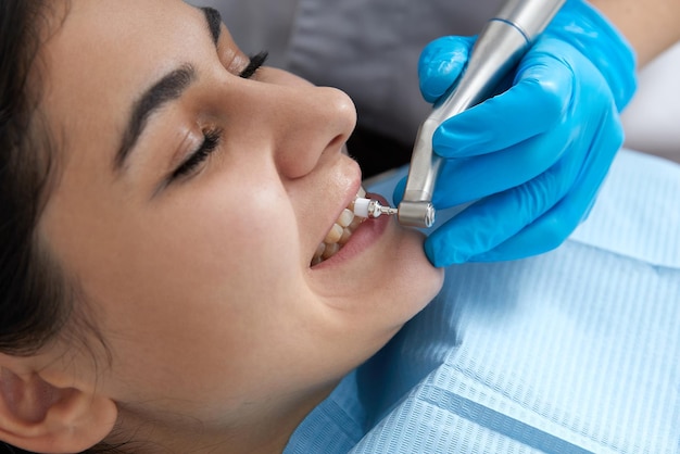 Mujer joven puliéndose los dientes en la clínica dental Concepto de limpieza dental profesional