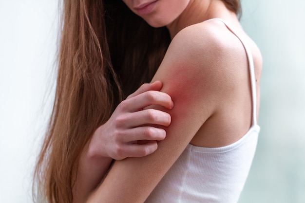 Foto mujer joven que sufre de picazón en la piel y rascarse un lugar con picazón.