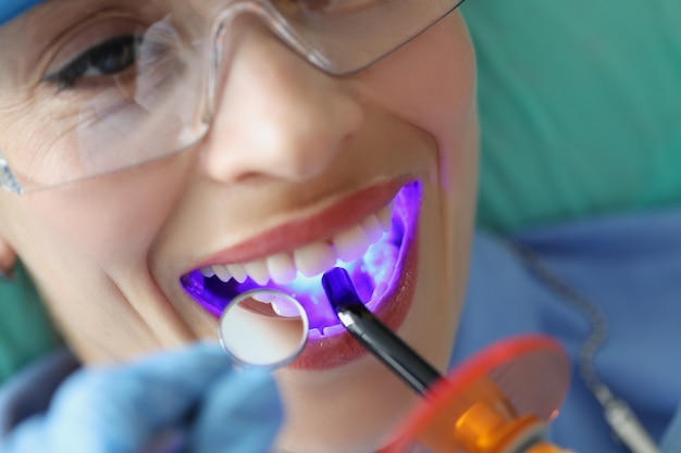 Mujer joven que trata los dientes con luz de curado LED inalámbrica primer plano de la máquina