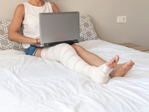 Una mujer joven sentada en la cama con la computadora portátil con la pierna vendada