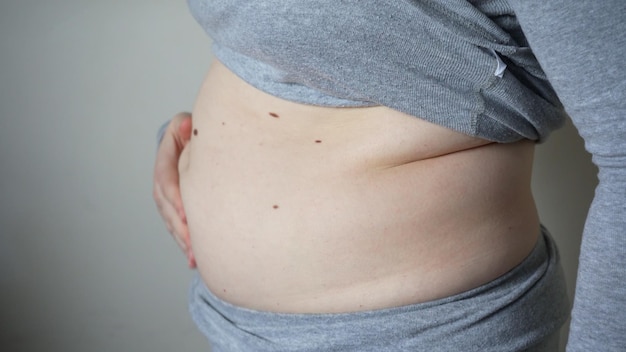 Mujer joven con sobrepeso o de talla grande con cirugía de barriga grande y concepto de división de grasa tamaño xl personas vida concepto de grasa y grasa