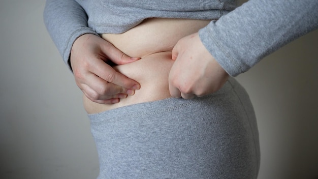 Mujer joven con sobrepeso o de talla grande con cirugía de barriga grande y concepto de división de grasa tamaño xl personas vida concepto de grasa y grasa