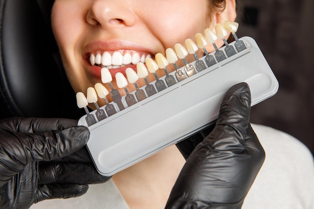 Foto mujer joven sonriente blanqueamiento dental cosmetológico en una clínica dental selección del tono del diente del implante