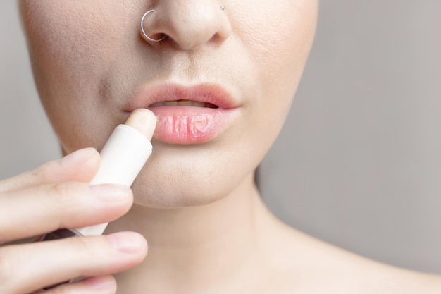 Mujer con labios secos Problema de piel seca y agrietada con enfermedad bucal Una mujer aplica un bálsamo hidratante para los labios de cerca