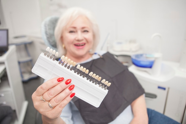 Mujer mayor riendo, hoding hacia fuera el gráfico de sombras para blanquear los dientes a la cámara en la clínica dental