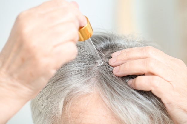 Mujer mayor con suero para el tratamiento de la caída del cabello