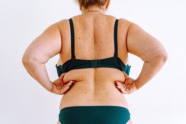 Foto mujer de mediana edad con piel flácida y flácida con manchas de la edad