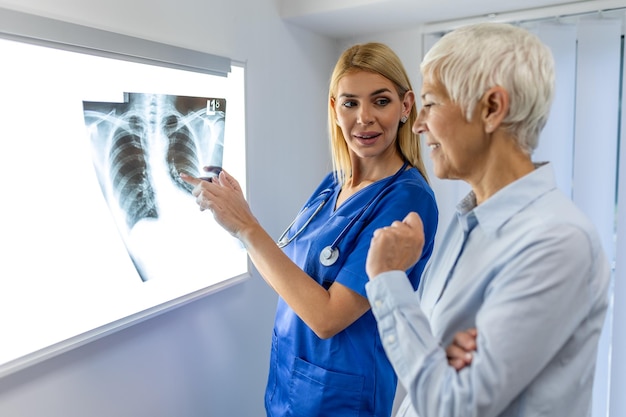 Mujer médico comprobando la película de rayos X en el laboratorio médico en el hospital explicando los resultados de la exploración del pulmón en la pantalla al paciente mayor