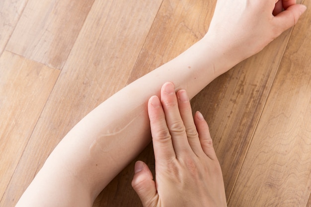 Mujer poniendo crema en su propio brazo