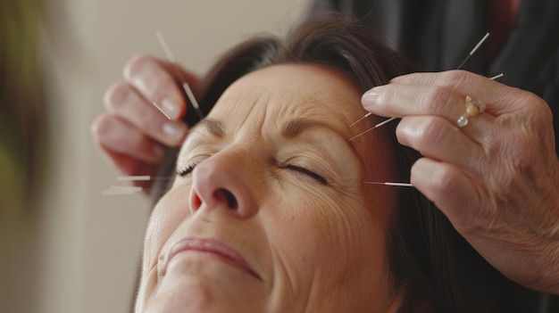 Foto una mujer que recibe terapia de acupuntura para aliviar el dolor