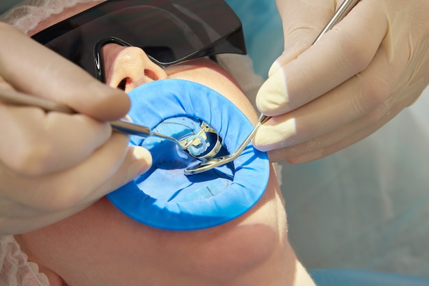 Mujer recibiendo tratamiento dental en el consultorio del dentista con protección de dique de goma dental