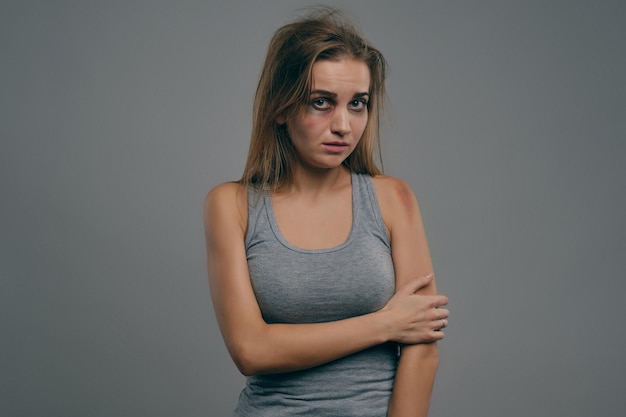 Mujer rubia afligida con cabello despeinado y moretones en la cara en camiseta gris manos dobladas posando sobre fondo gris Abuso de violencia doméstica Depresión desesperación Espacio de copia de primer plano