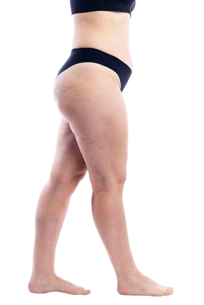 Mujer con sobrepeso con celulitis y venas varicosas en ropa interior negra Altura completa Obesidad y enfermedad Aislado sobre fondo blanco Vista lateral vertical