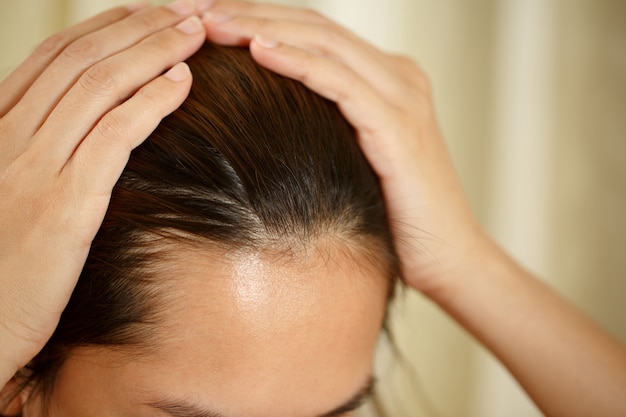 Una mujer tiene problemas con el cabello y el cuero cabelludo.