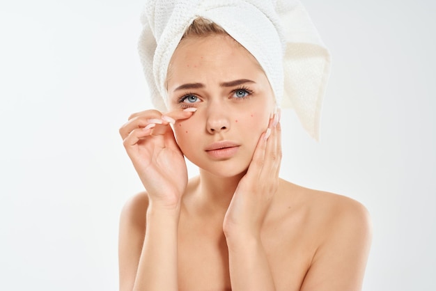 Foto mujer con una toalla en la cabeza cuidado de la piel rostro dermatología higiene foto de alta calidad