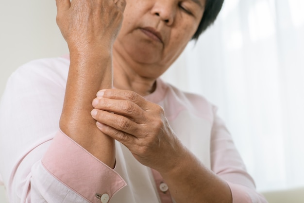 Las mujeres mayores se rascan el brazo el picor en el concepto de brazo eccema, salud y medicina