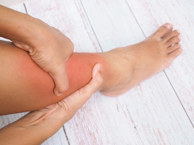 Mujeres que sufren dolor en las piernas, dolor en el tobillo, inflamación e hinchazón roja.