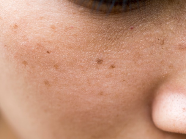 Foto las mujeres tienen pecas en la cara