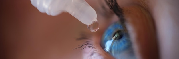 Mulher aplicando colírio para cuidados com os olhos e conceito de beleza