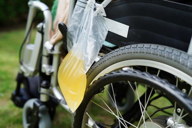 Mulher asiática com deficiência com saco de urina na cadeira de rodas