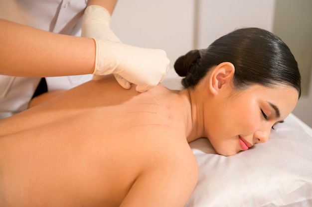 Mulher bonita recebeu tratamento de acupuntura nas costas por terapeutas chineses