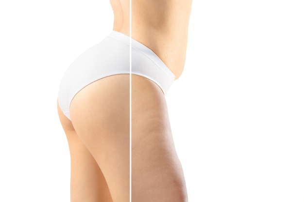 Foto mulher com excesso de peso, pernas e barriga gordas com celulite, corpo feminino obesidade em comparação com o corpo em forma