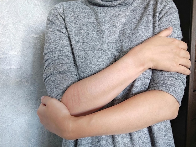Mulher com ferimentos após automutilação envolve os braços em torno de si mesma autoagressão saúde mental