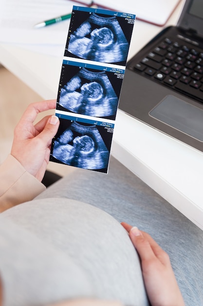 Mulher com imagem de ultrassom. Imagem recortada de uma mulher segurando um sonograma enquanto está sentado à mesa com um laptop