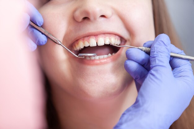 Mulher de close-up sorrindo em um check-up no dentista em uma clínica dentária