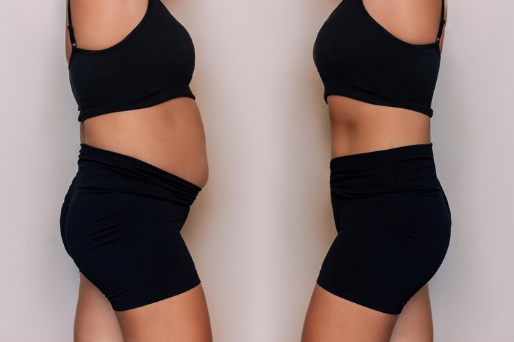 Foto mulher de roupa esportiva preta com barriga gorda e abdômen fino tonificado antes e depois de perder peso