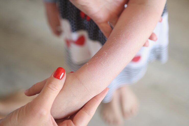 Foto mulher examinando erupção vermelha nos braços de irritação infantil no corpo das meninas