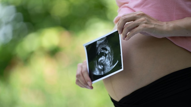 Mulher grávida asiática mostra com bebê de ultrassom grávida relaxando no parque verde