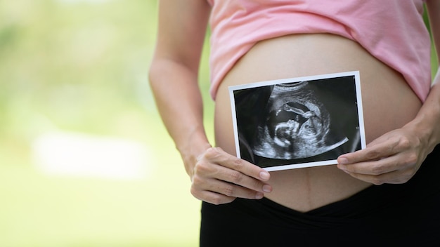 Mulher grávida asiática mostra com bebê de ultrassom Grávida relaxando no parque verde