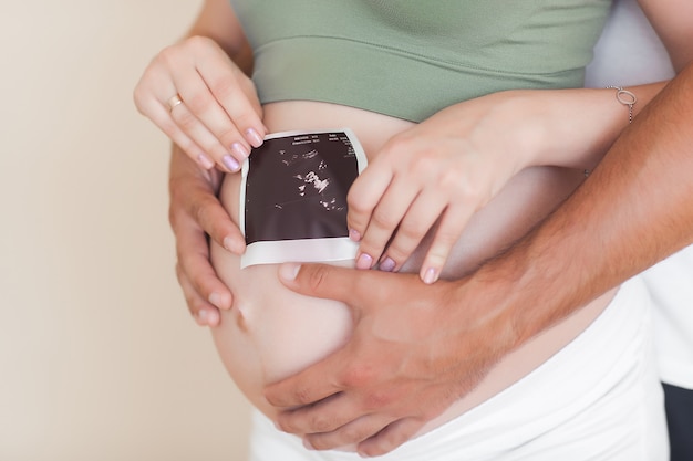 Mulher grávida. Fêmea irreconhecível esperando. Homem e mulher, abraçando o estômago e segurando uma foto de ultra-som de seu bebê.