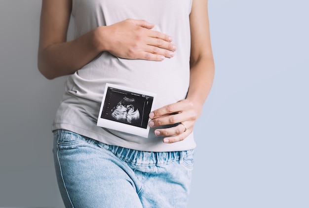 Mulher grávida segurando imagem de ultrassom do bebê barriga grávida e foto da ultrassonografia nas mãos da mãe