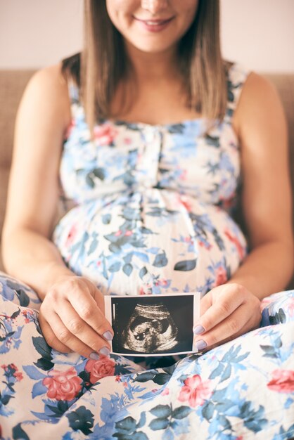 Foto mulher grávida sorridente mostrando imagem de ultrassom de bebê