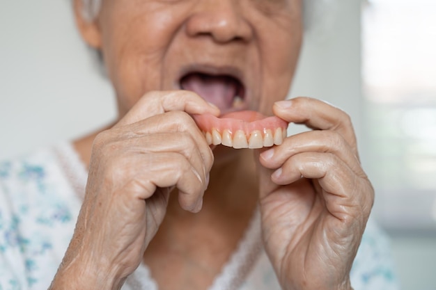 Mulher idosa asiática paciente segurando para usar dentadura conceito médico forte e saudável