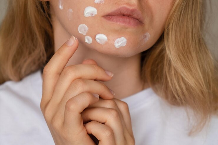 Foto mulher irreconhecível aplica creme de maquiagem sérum cura para a acne no rosto close-up acne em mulheres