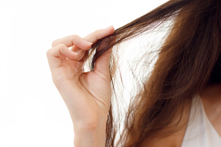 Mulher jovem com problema de cabelo