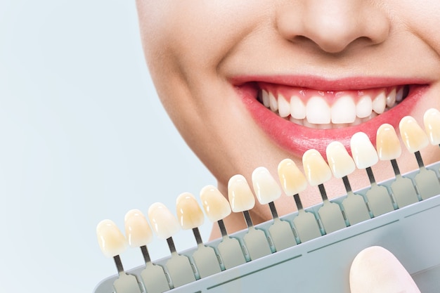 Mulher jovem sorridente. Clareamento cosmético dentário em clínica odontológica. seleção do tom do