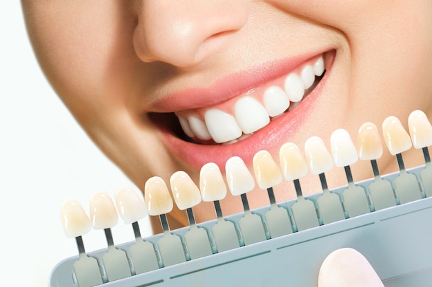 Mulher jovem sorridente. Clareamento cosmético dos dentes em clínica odontológica. seleção do tom do dente do implante.