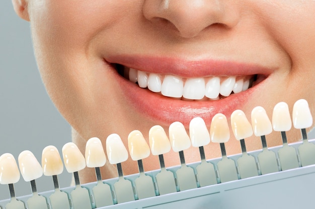 Mulher jovem sorridente. Clareamento cosmético dos dentes em clínica odontológica. seleção do tom do dente do implante.