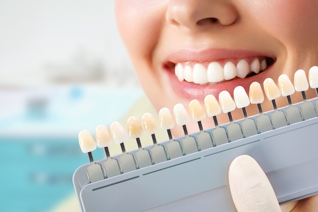 Mulher jovem sorridente. Clareamento cosmético dos dentes em clínica odontológica. seleção do tom do dente do implante.
