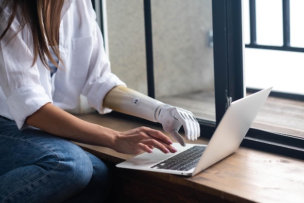 Mulher motivada usando braço protético trabalhando ou aprendendo computador notebook garota com deficiência digitando texto membro protético artificial