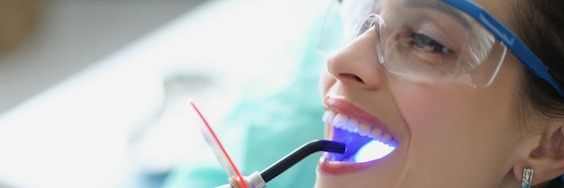 Mulher na cadeira do gabinete de estomatologia recebendo procedimento de clareamento boca amplamente aberta