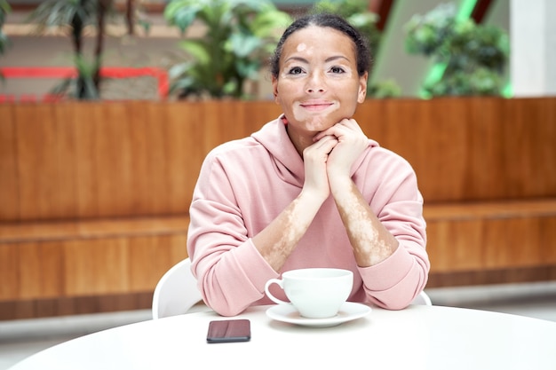 Mulher negra afro-americana com problema de pele com pigmentação vitiligo vestida de interior com capuz rosa mesa de estar