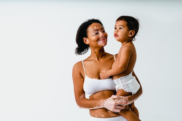 Mulher negra feliz com vitiligo segurando seu bebê em fundo colorido