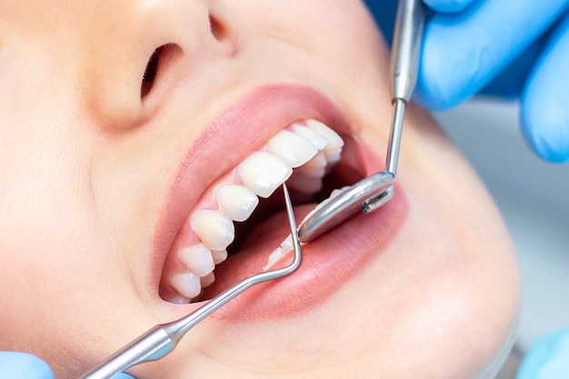 Foto mulher no dentista para exame de dentes