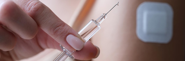Mulher segurando uma seringa com a vacina nas mãos perto do ombro com gesso closeup